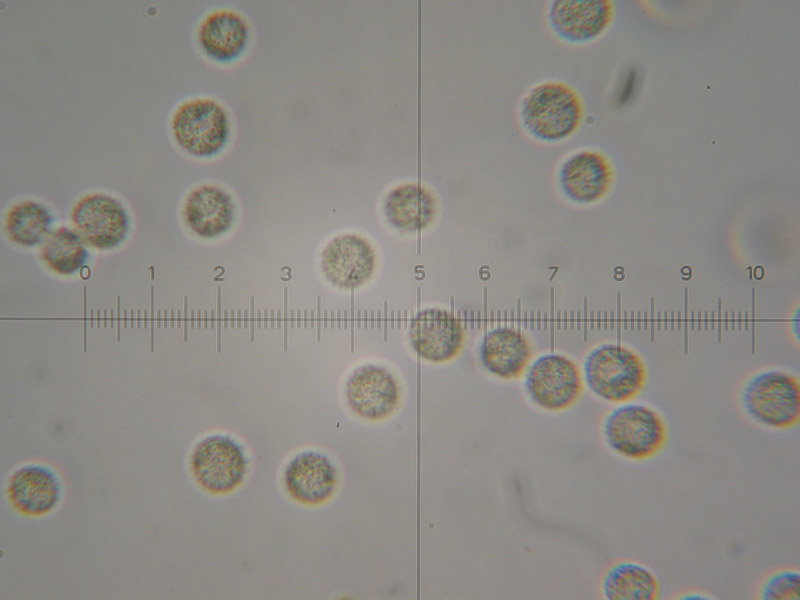 Lycogala epidendrum (J.C. Buxb. ex L.) Fr.(PROVA)